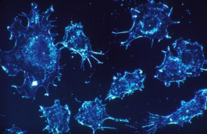 Autres lésions cellulaires