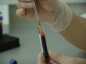 Taux de cholestérol