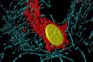 Spécialisation cellulaire: Fibroblaste