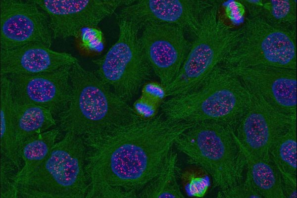 Division cellulaire différents stades