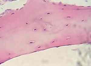 Tissu cartilage