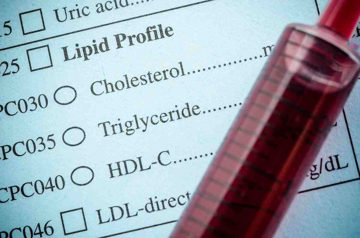 Hyperlipidémie