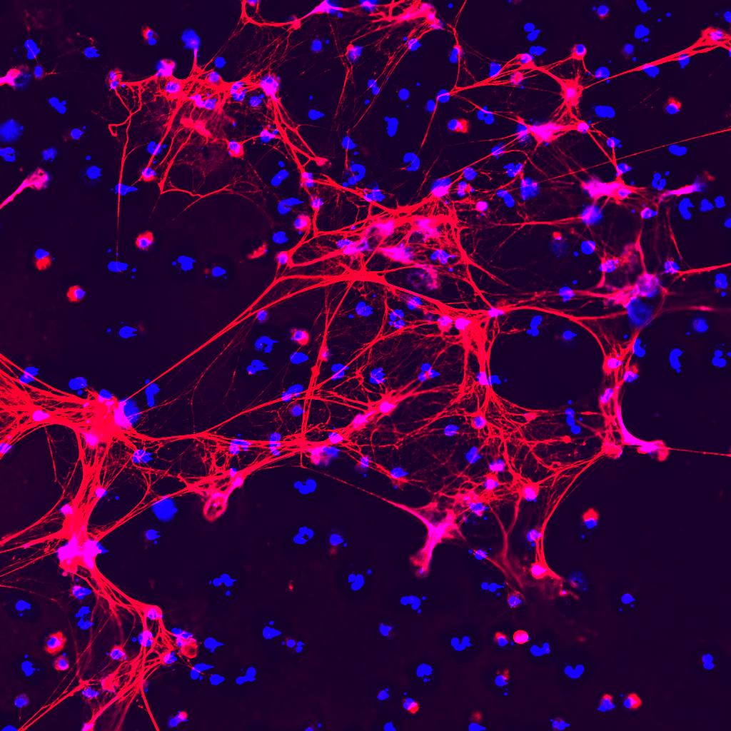 Cellule immunitaire granulocyte neutrophile