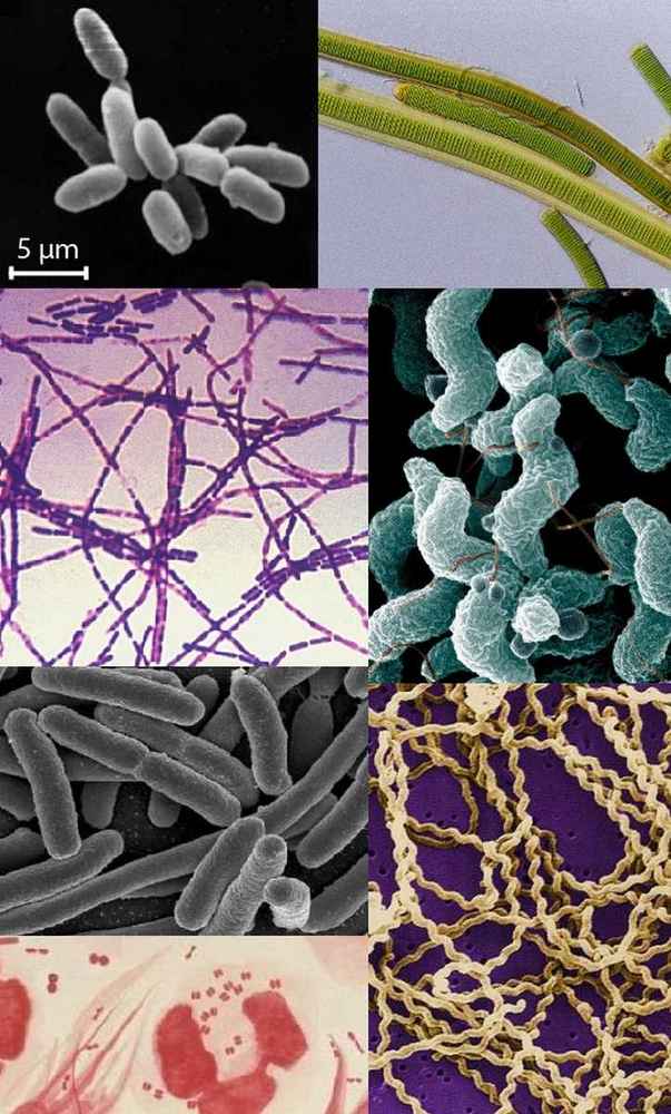 Procaryotes