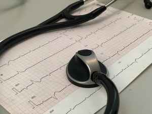 Electrocardiogramme