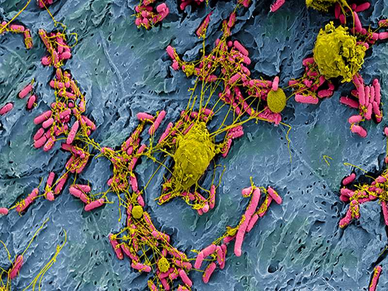 E. Coli
