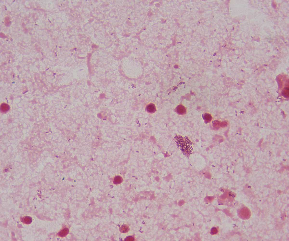 Listeria monocytogenes