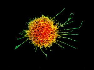 Système immunitaire, cellule tueuse naturelle
