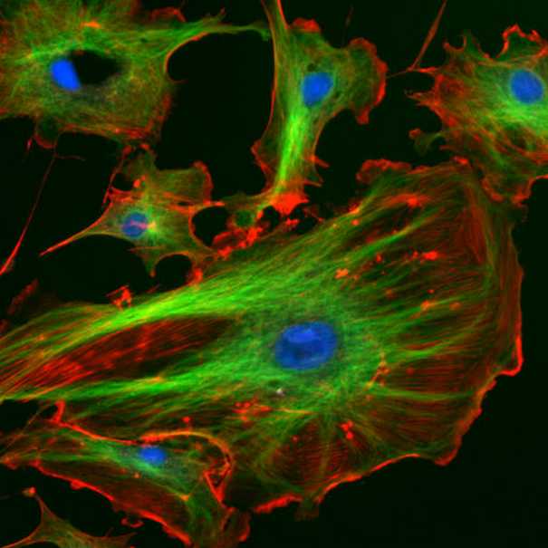 Cellules endothéliales bovines vues au microscope. 