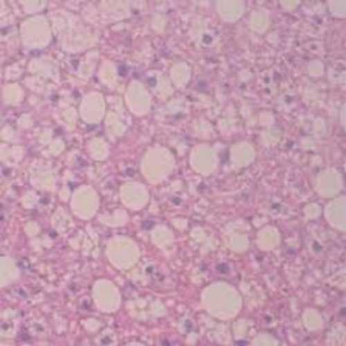 Parabacteroides distasonis